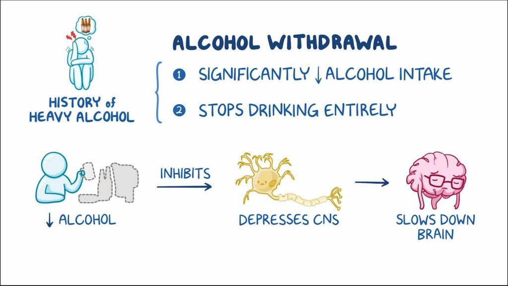 Can Alcohol Withdrawal Kill You? Warning Signs You Should Never Ignore 1 Illustration explaining alcohol withdrawal effects |. Woodmont